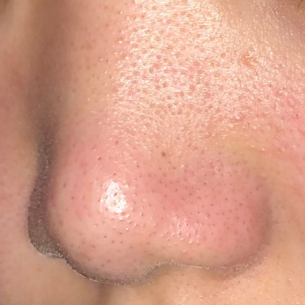 デュオ ザ クレンジングバーム/DUO/クレンジングバームを使ったクチコミ(2枚目)