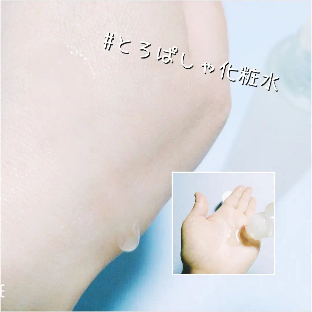 オルビスユー ローション/オルビス/化粧水を使ったクチコミ（3枚目）