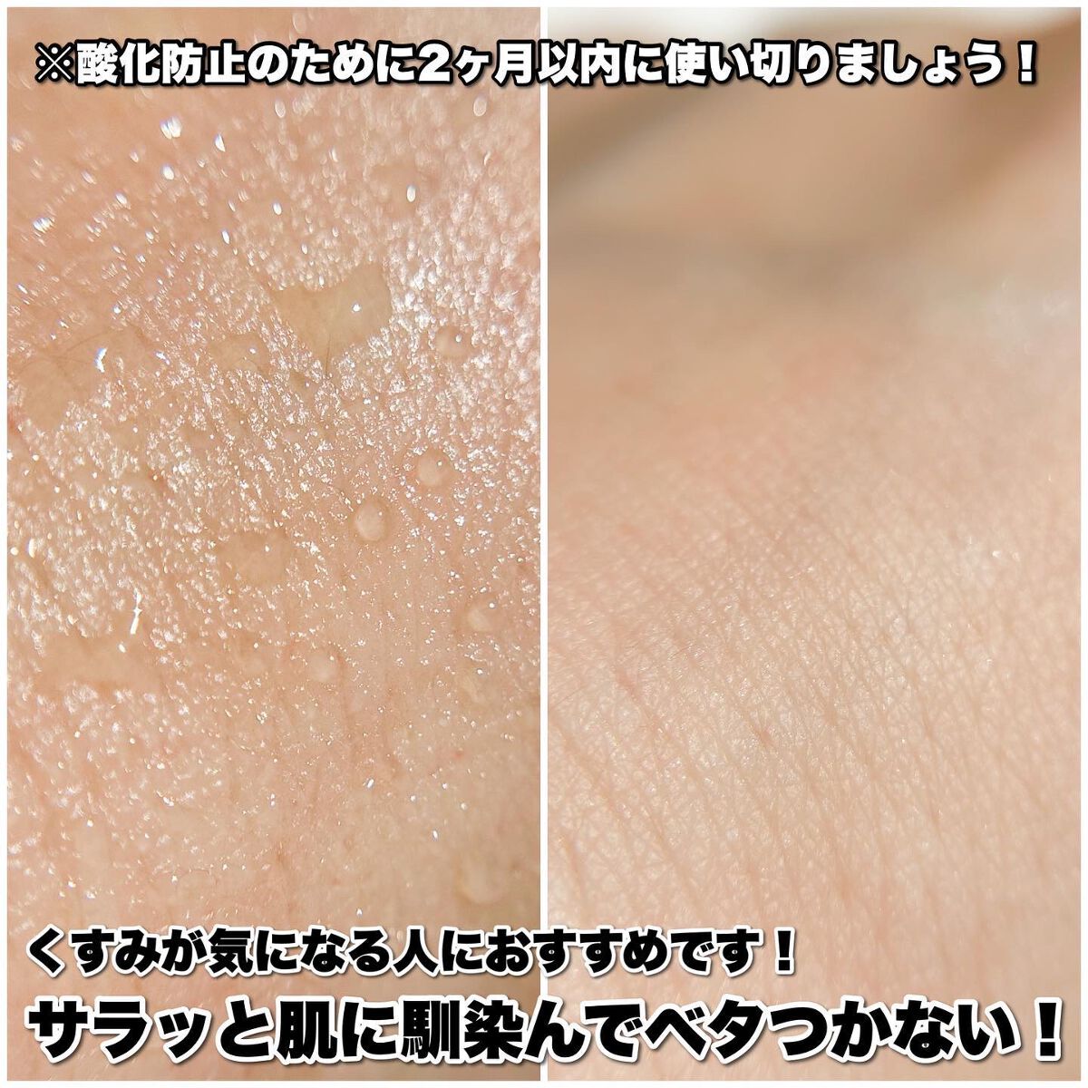 RXザ・ビタミンC23セラム/COSRX/美容液を使ったクチコミ(5枚目)