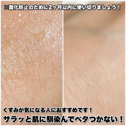 RXザ・ビタミンC23セラム/COSRX/美容液を使ったクチコミ(5枚目)