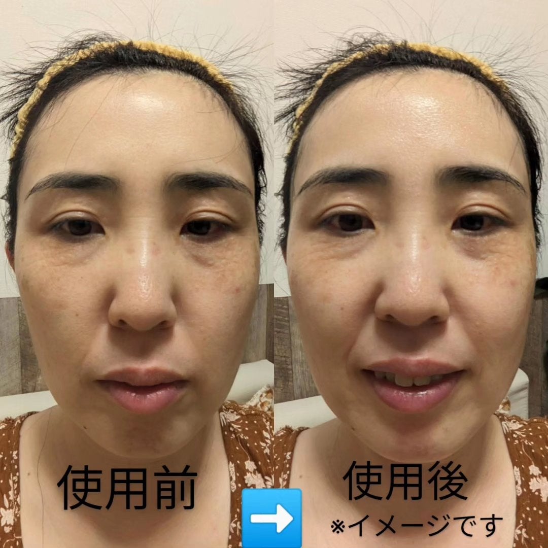 レジュセル お試しセット/RESUCELL/その他スキンケアを使ったクチコミ(7枚目)