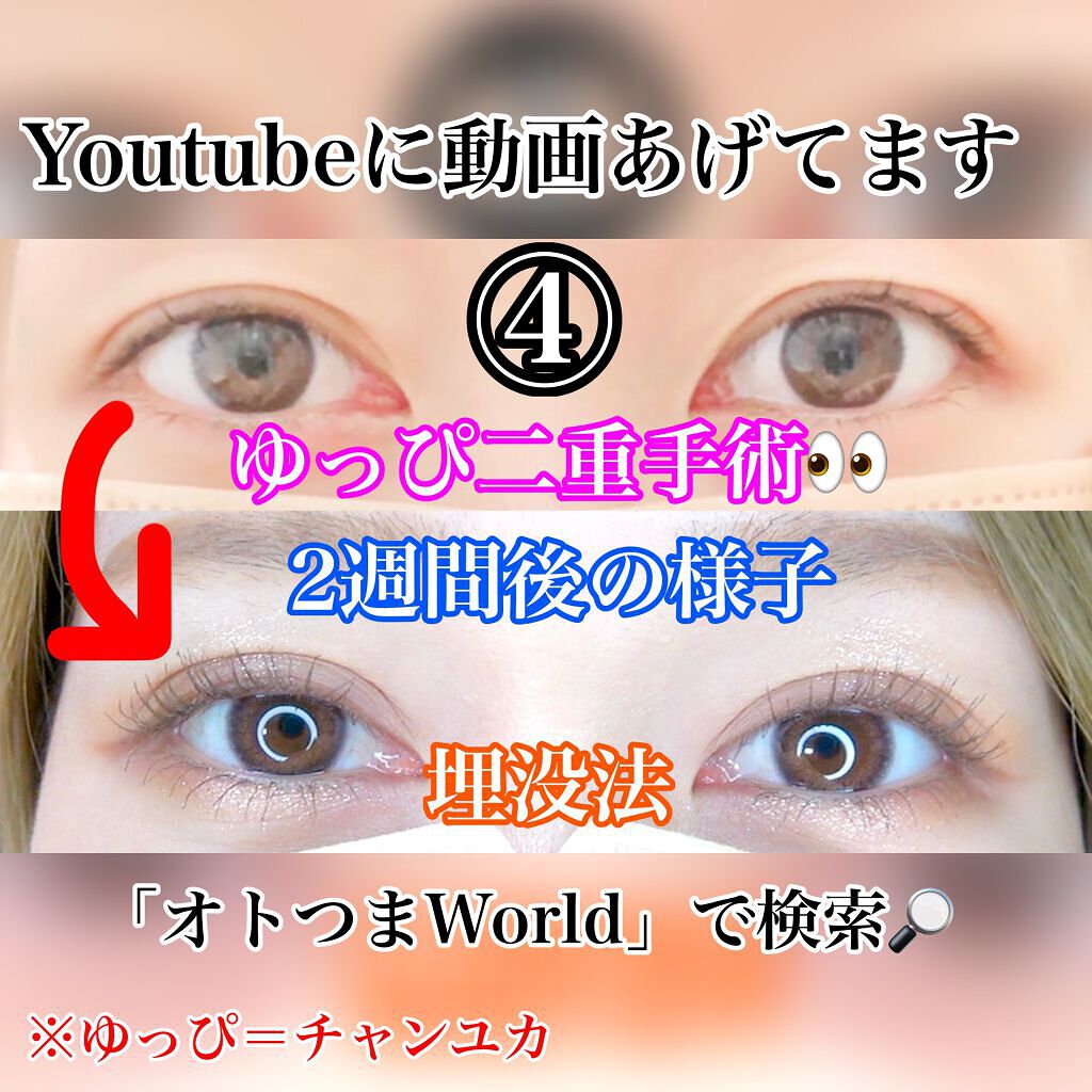 ビュームワンデー/ビューム/ワンデー（１DAY）カラコンを使ったクチコミ（1枚目）