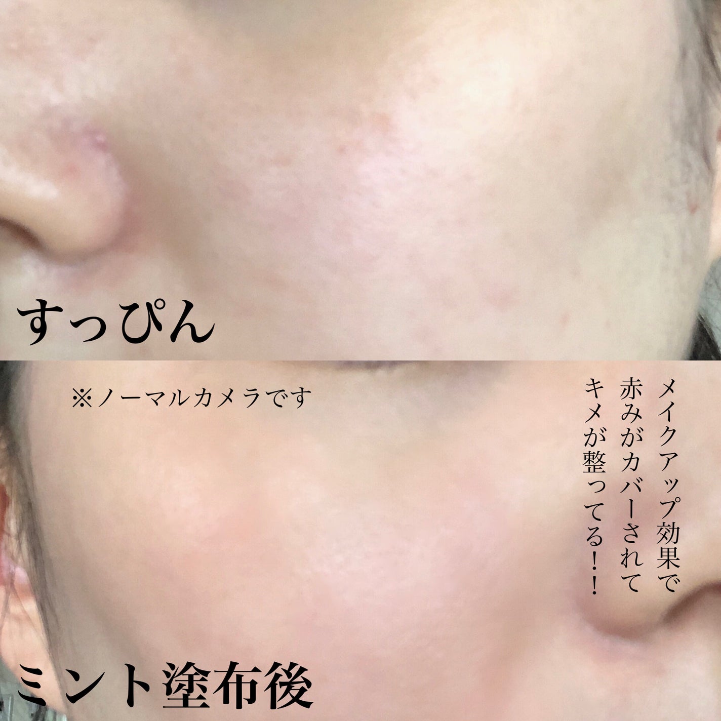 リードルショット100/VT/美容液を使ったクチコミ(5枚目)