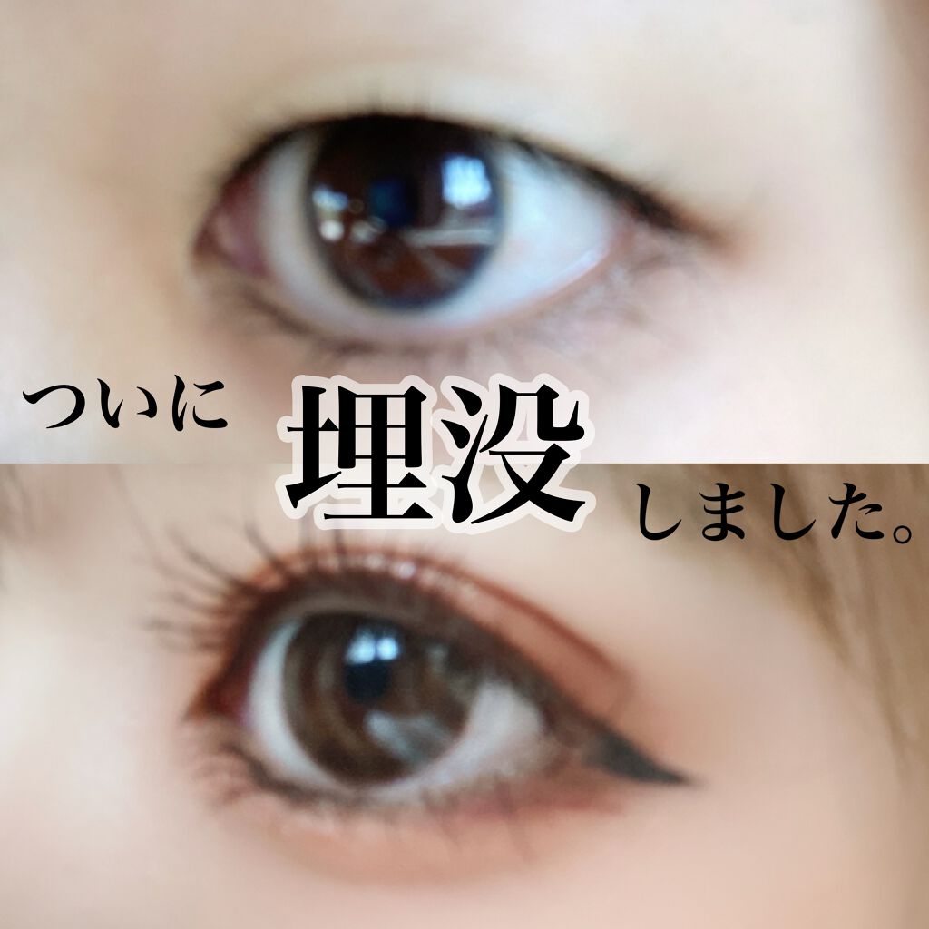 ちび☺︎ on LIPS 「脱☆一重!念願の埋没してきました、、、!二重整形を考えている方..」(1枚目)