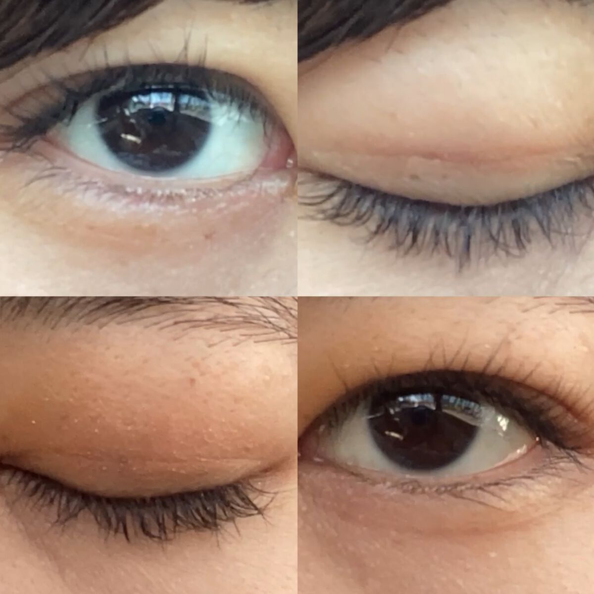 mia♡ on LIPS 「埋没日記♡今日で4日目です!左目はまだ若干大きく開くと違和感あ..」(2枚目)