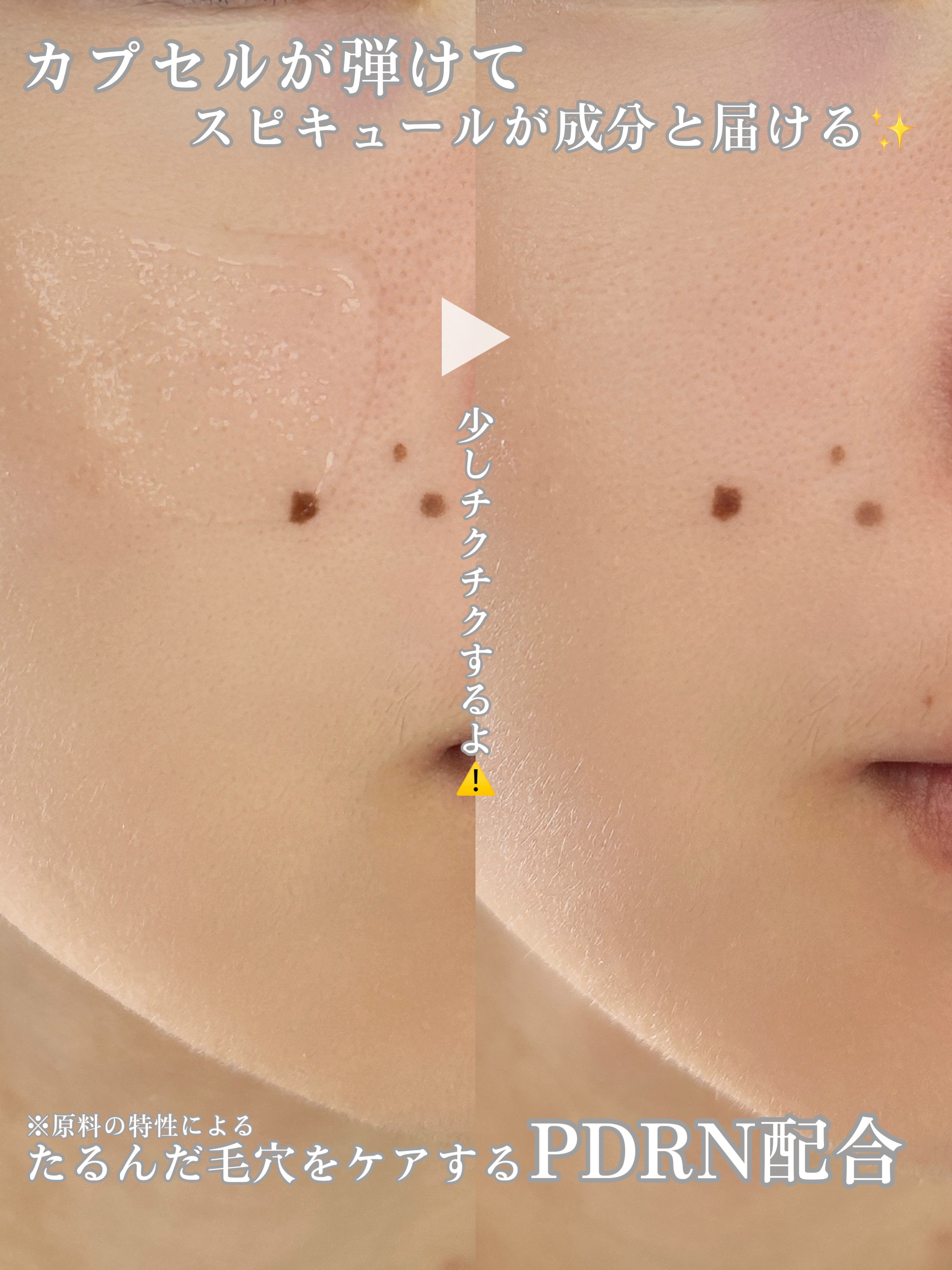 ピトピディーアールエヌ カプセルショット アンプル/One-day's you/美容液を使ったクチコミ（3枚目）