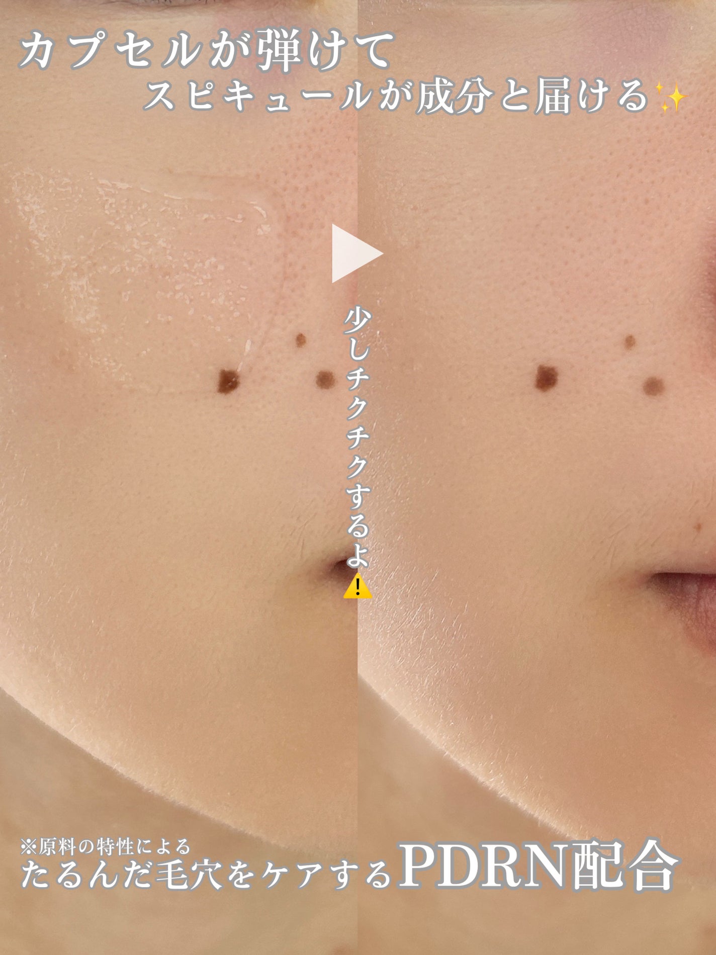 ピトピディーアールエヌ カプセルショット アンプル/One-day's you/美容液を使ったクチコミ(3枚目)