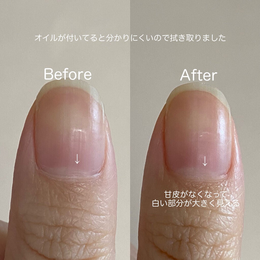甘皮ケアオイル/無印良品/ネイルオイル・トリートメントを使ったクチコミ(2枚目)