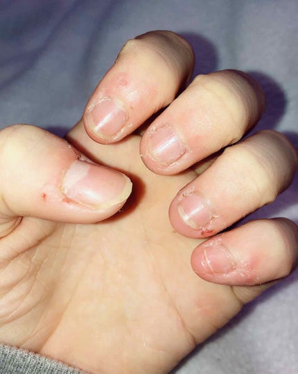 カラフルネイルズ TO(トリートメントオイル)/キャンメイク/ネイルオイル・トリートメントを使ったクチコミ(2枚目)