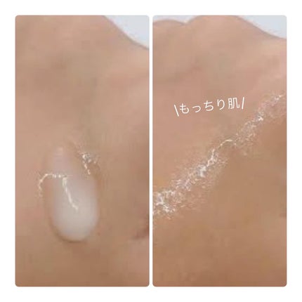 美容オタクmik on LIPS 「肌トラブル*1のアルゴリズムを断ち切る処方のレチノール美容液🫰..」(2枚目)