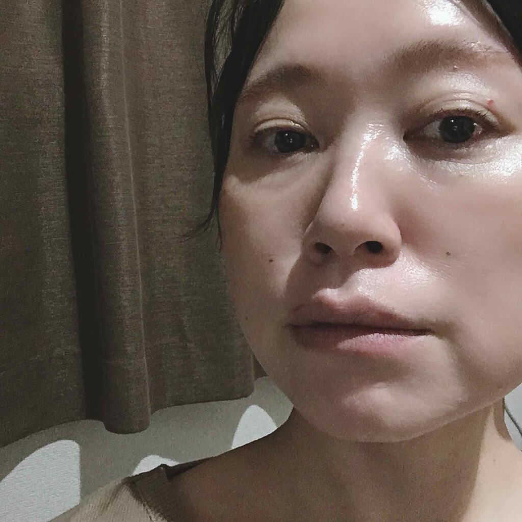 ハトムギエキス化粧水/プラチナレーベル/化粧水を使ったクチコミ(2枚目)