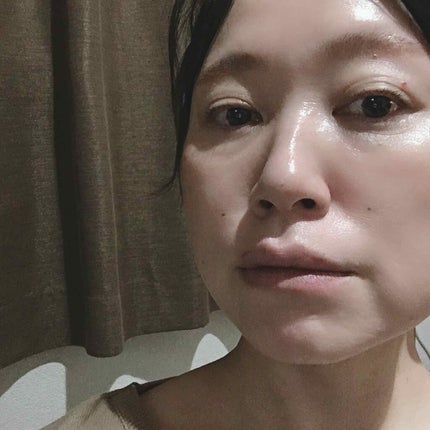 ハトムギエキス化粧水/プラチナレーベル/化粧水を使ったクチコミ(2枚目)