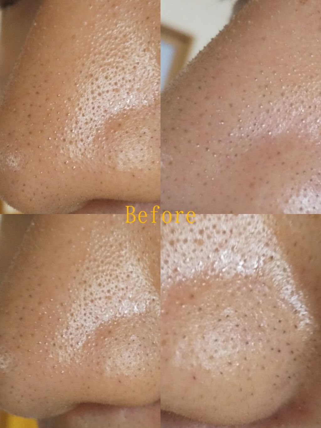 シラクル ビューティシート/Ciracle/トナーパッドを使ったクチコミ（2枚目）