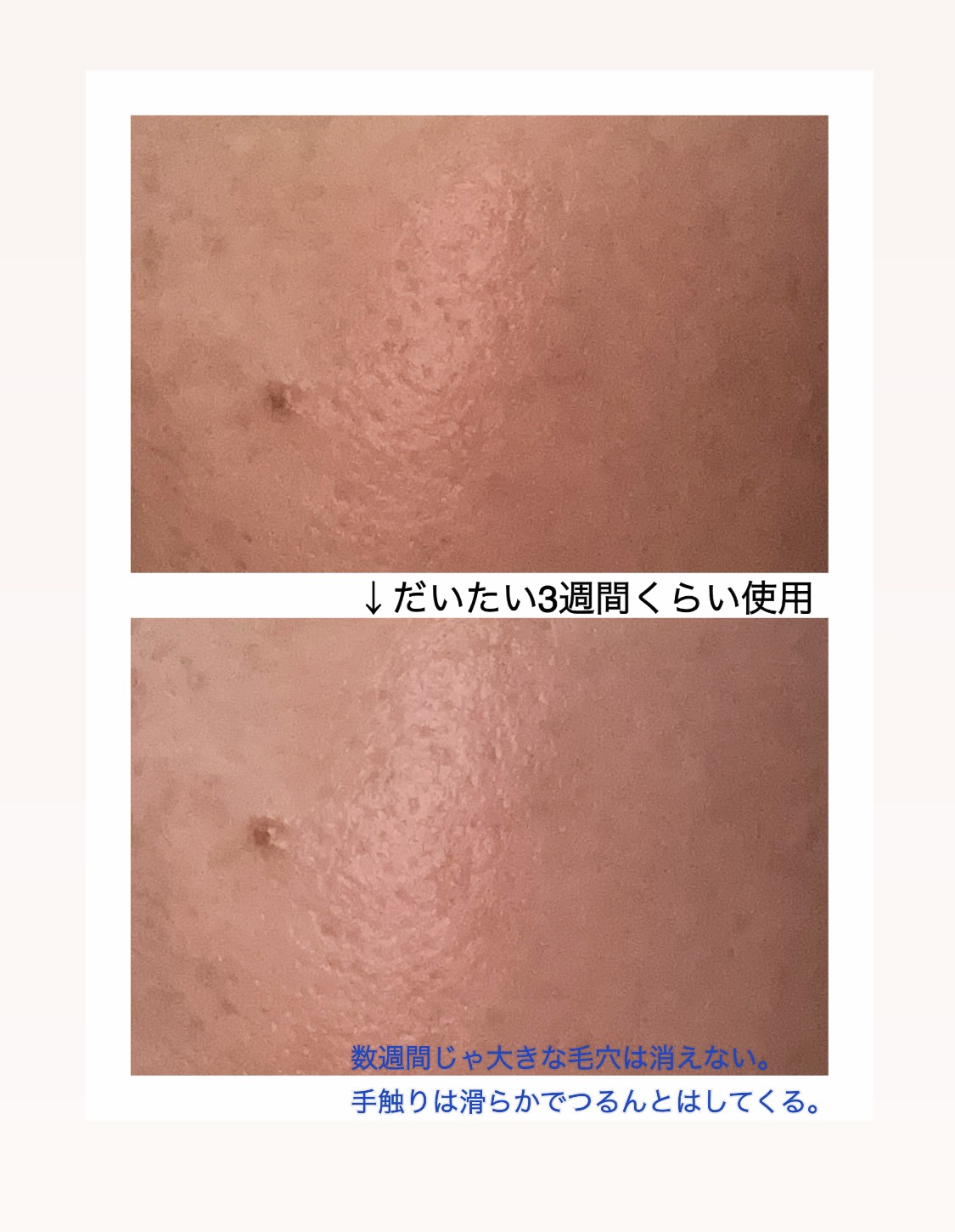 ゼロ1DAYエクソソームショット2000/MEDICUBE/美容液を使ったクチコミ（3枚目）