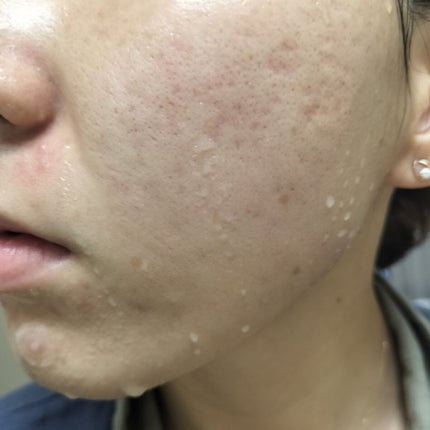 を使ったクチコミ(2枚目)