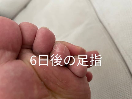 足裏角質パック ブラックミントの香り/EVERYYOU/レッグ・フットケアを使ったクチコミ(4枚目)