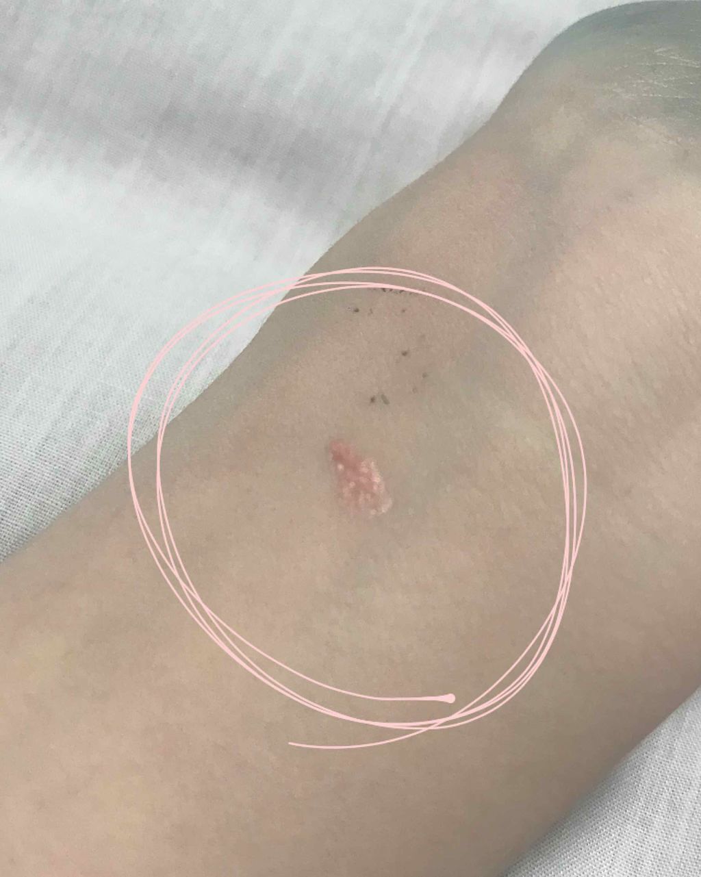 【旧品】マシュマロフィニッシュパウダー/キャンメイク/プレストパウダーを使ったクチコミ（2枚目）