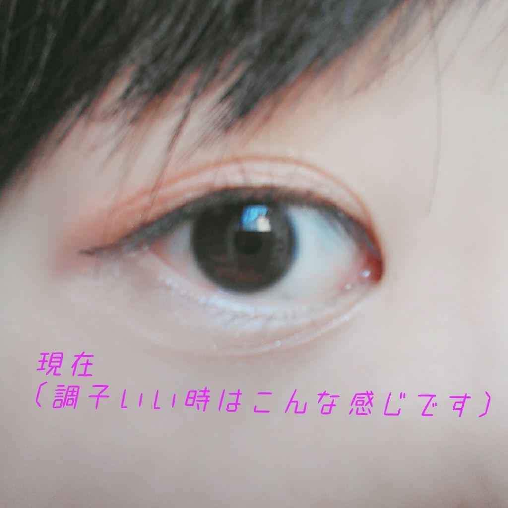 アイトーク/アイトーク/二重まぶた用アイテムを使ったクチコミ（3枚目）