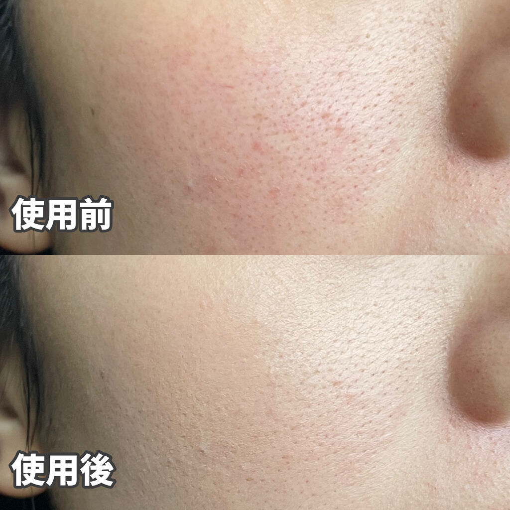 ロングラスティングチップコンシーラー/LUNA/リキッドコンシーラーを使ったクチコミ（3枚目）