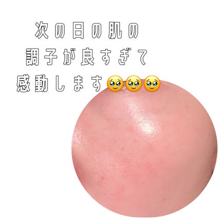 ハイドロセラノールリアルディープマスク/Biodance/シートマスク・パックを使ったクチコミ(6枚目)