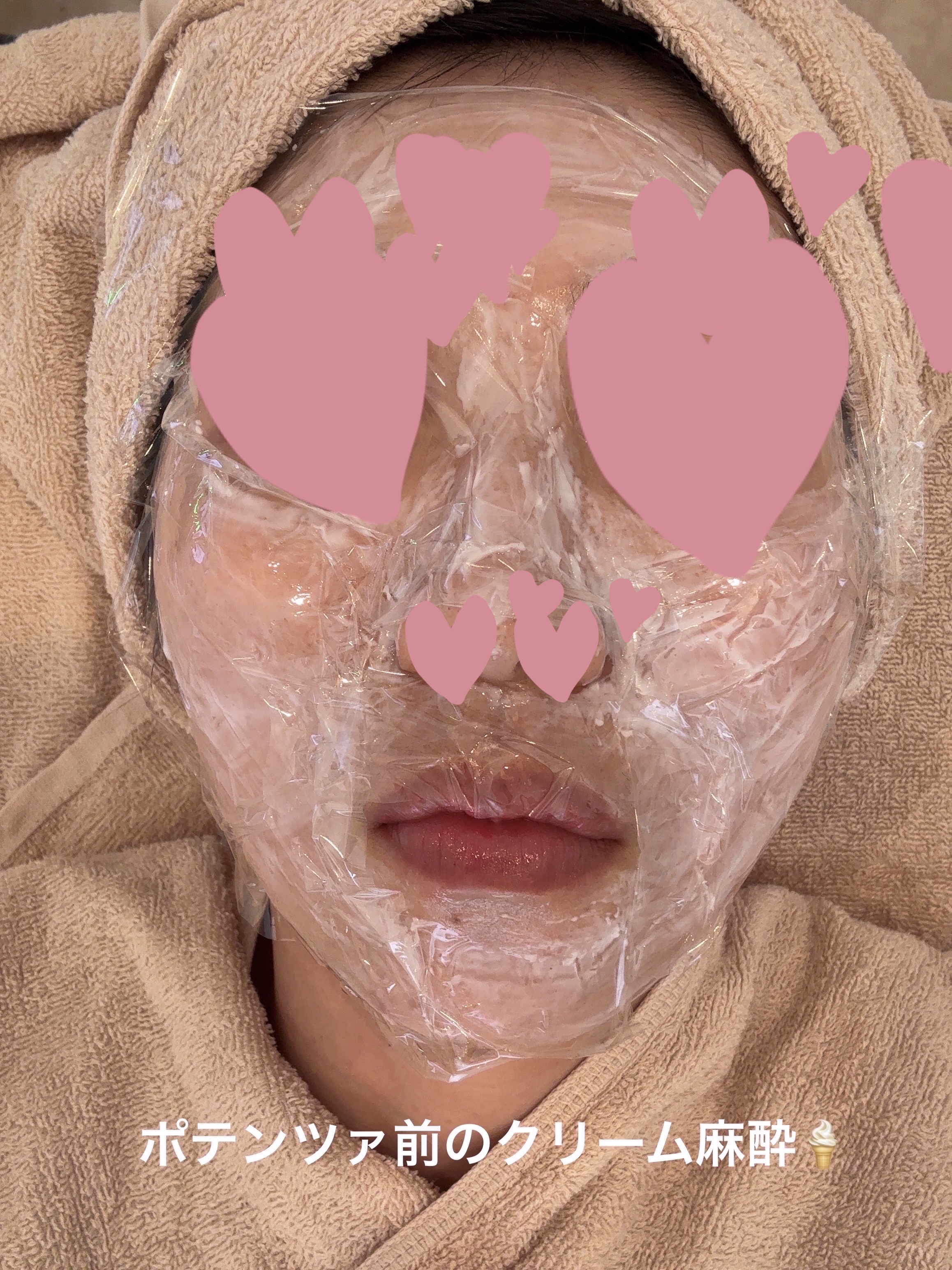 DRX AZAクリア/ロート製薬/その他スキンケアを使ったクチコミ（3枚目）