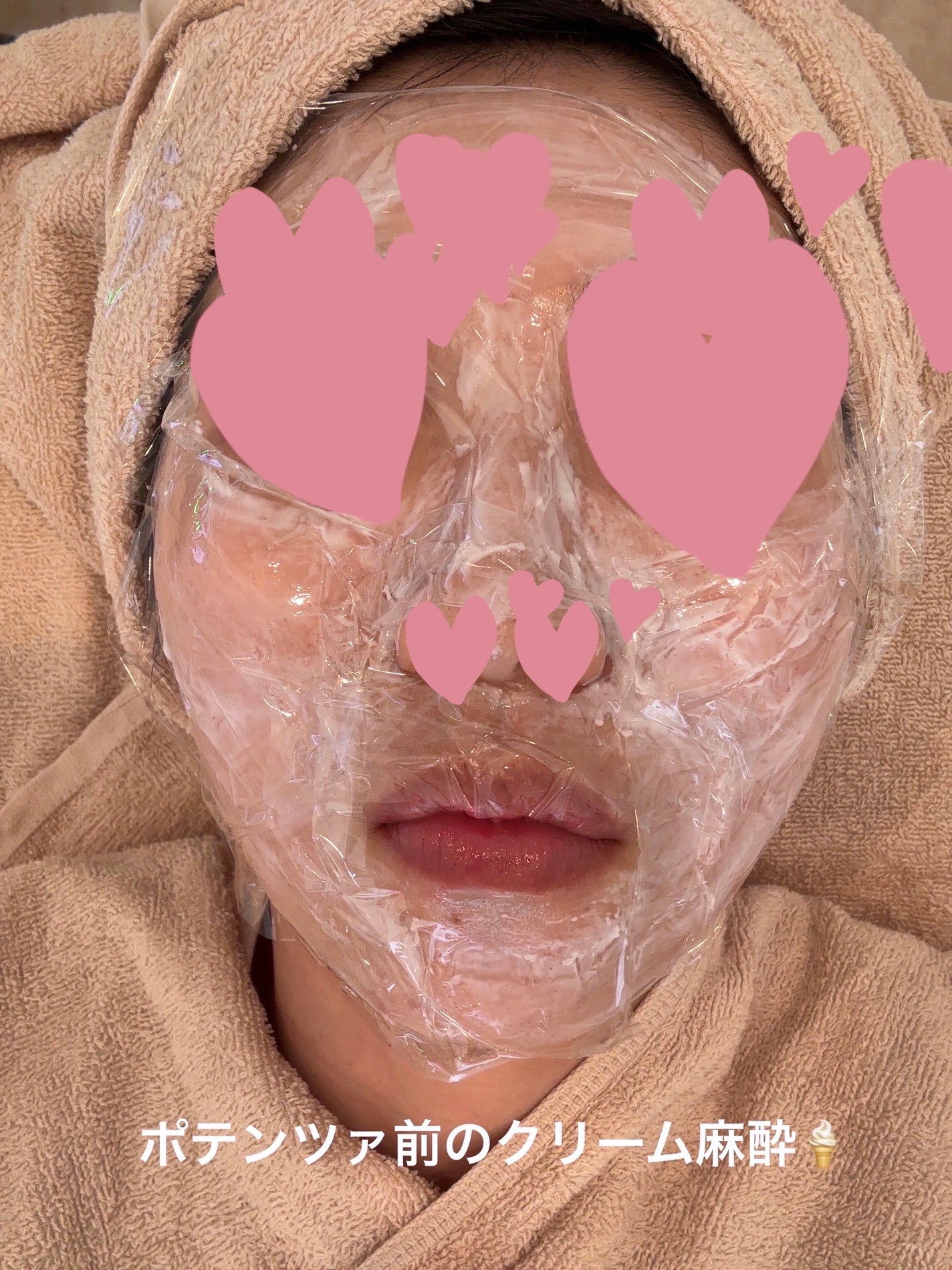 DRX AZAクリア/ロート製薬/その他スキンケアを使ったクチコミ(3枚目)