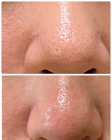 ノーモアブラックヘッド(ノーズピーリング)/One-day's you/スクラブ・ゴマージュを使ったクチコミ(2枚目)