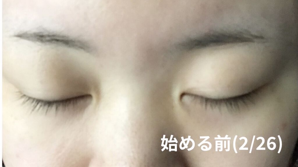 スカルプD ボーテ ピュアフリーアイラッシュセラム/アンファー(スカルプD)/まつげ美容液を使ったクチコミ（3枚目）