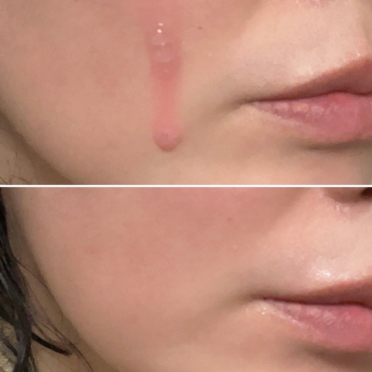 PDRNピンクアンプル PDRN 10,000ppm配合/MEDICUBE/美容液を使ったクチコミ(4枚目)