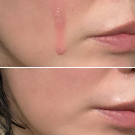 PDRNピンクアンプル PDRN 10,000ppm配合/MEDICUBE/美容液を使ったクチコミ(4枚目)