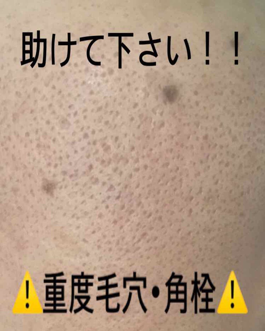 おうちdeエステ 肌をなめらかにする マッサージ洗顔ジェル/ビオレ/その他洗顔料を使ったクチコミ(1枚目)