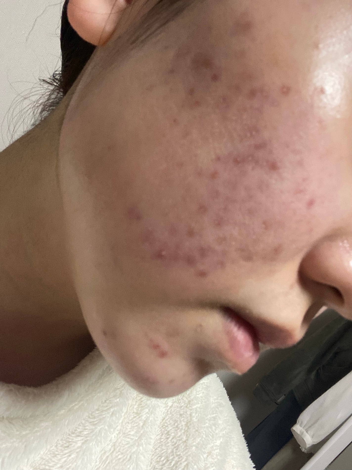 ããð± on LIPS ããã£ãšæ°ã«ãªã£ãŠããã·ã«ã¬ãã賌å
¥ããã®ã§ã2ã¶æã»ã©äœ¿çšãç¶..ãïŒ3æç®ïŒ