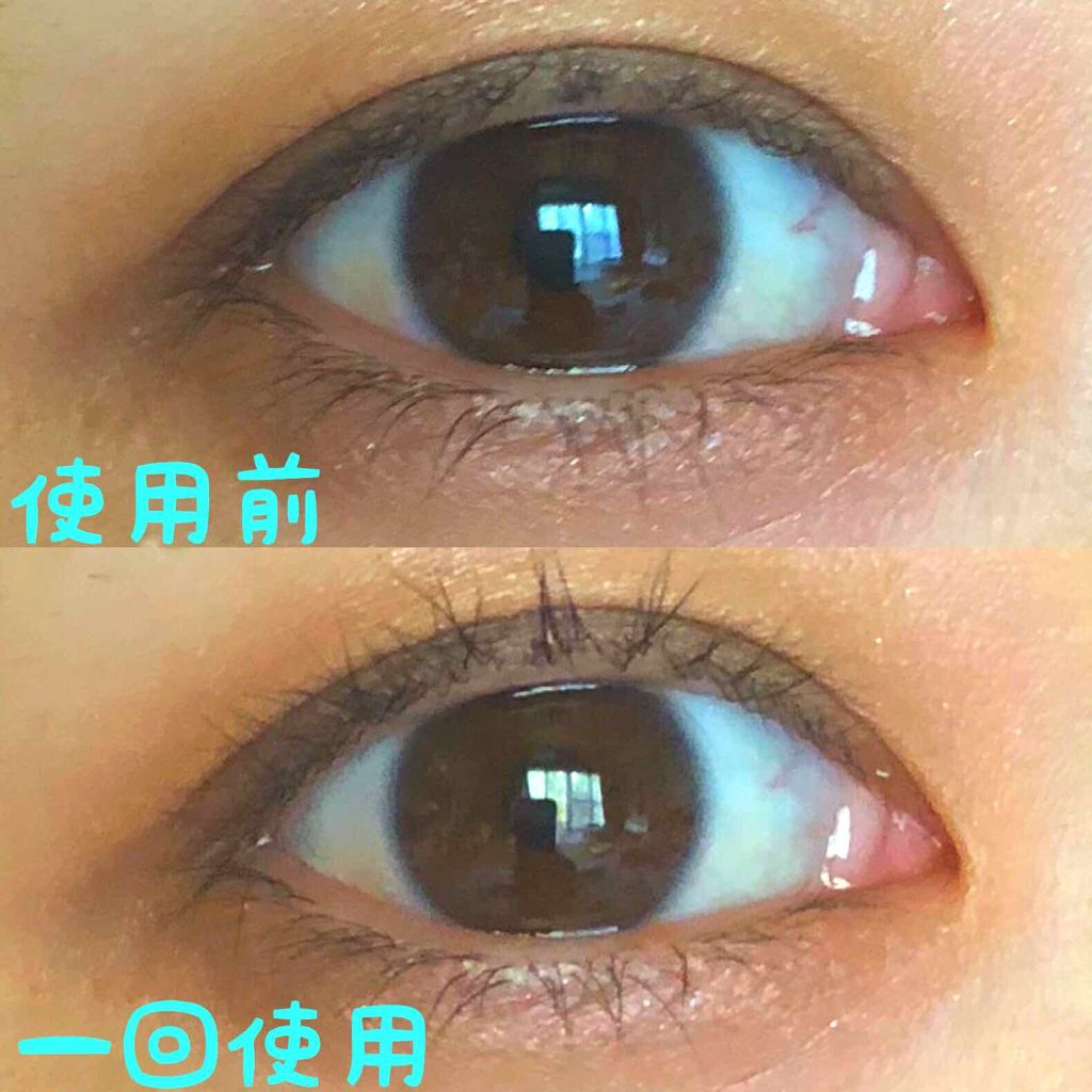 ひとえ・奥ぶたえ用カーラー/アイプチ®/ビューラーを使ったクチコミ(3枚目)