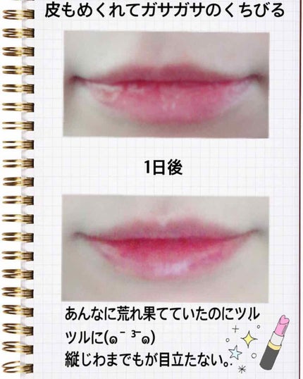 メディカルリップn(医薬品)/メンソレータム/その他を使ったクチコミ(3枚目)