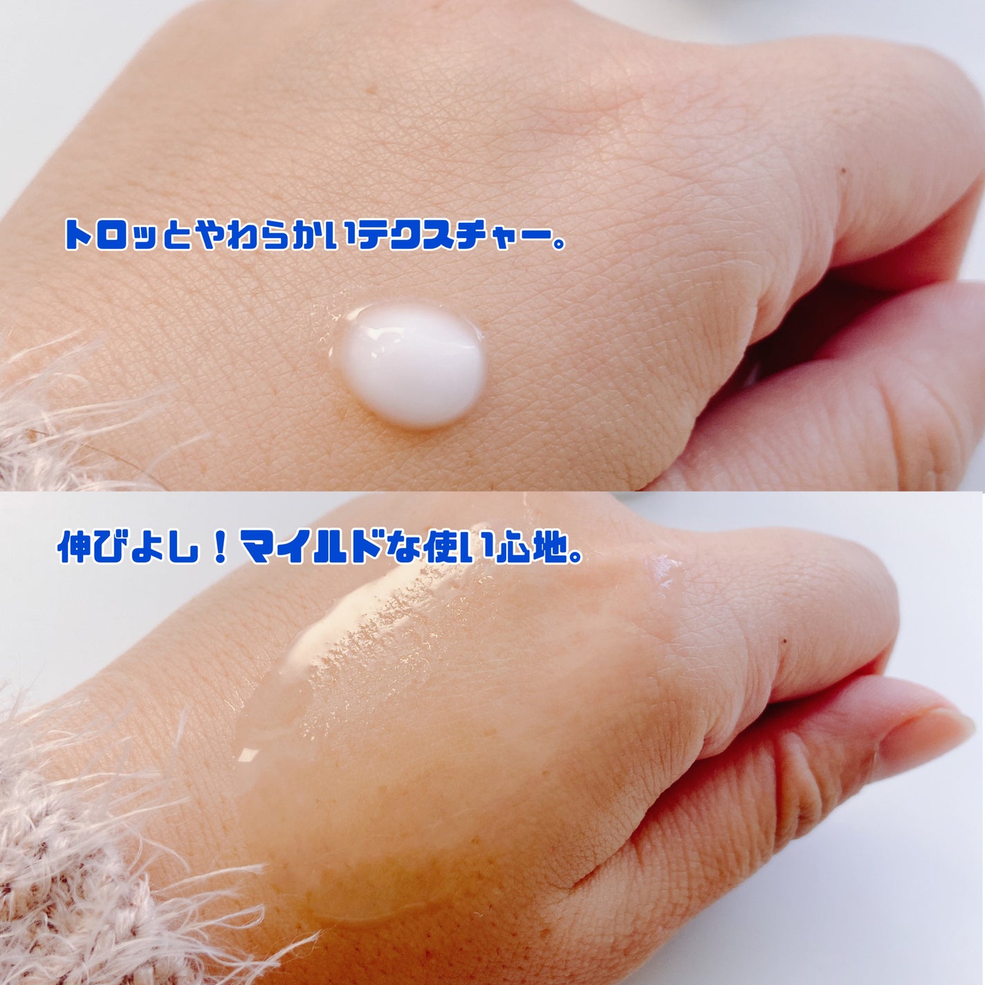 マイルドリードルショット50/VT/美容液を使ったクチコミ(2枚目)