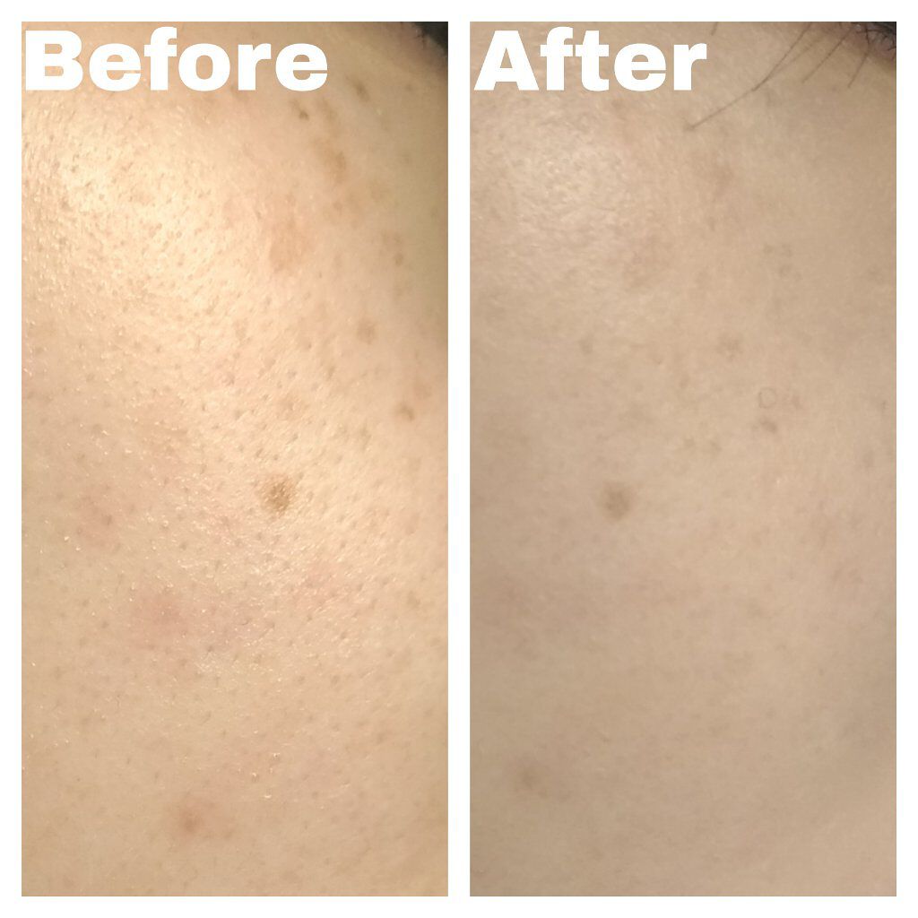 フィットミー コンシーラー/MAYBELLINE NEW YORK/リキッドコンシーラーを使ったクチコミ(5枚目)