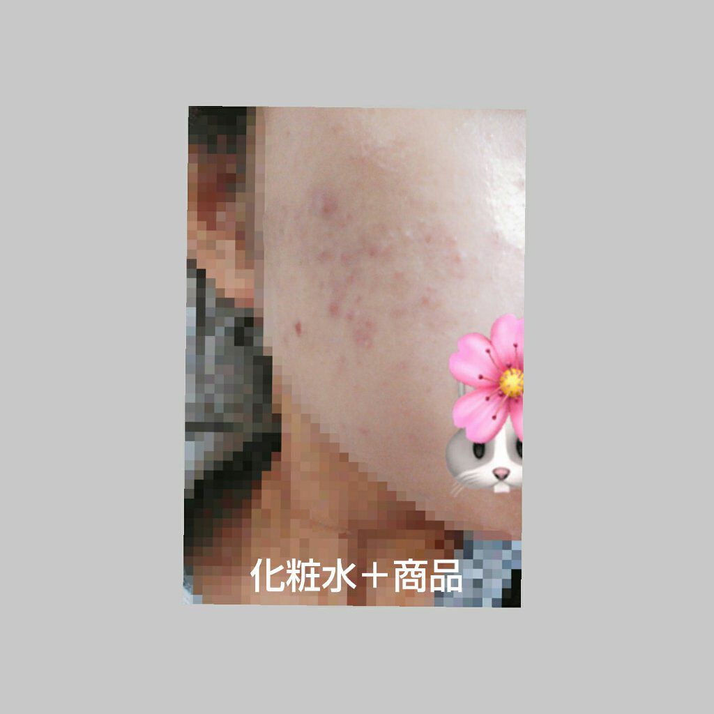 ããªã¬UV ã¢ã¯ã¢ãªãã ã©ã€ãã¢ãããšãã»ã³ã¹/ããªã¬/æ¥çŒãæ¢ãã¯ãªãŒã ã䜿ã£ãã¯ãã³ãïŒ3æç®ïŒ