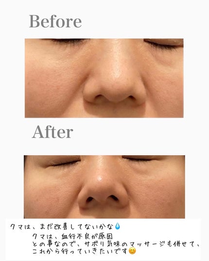 Kooスキンローション/Koo/化粧水を使ったクチコミ(8枚目)