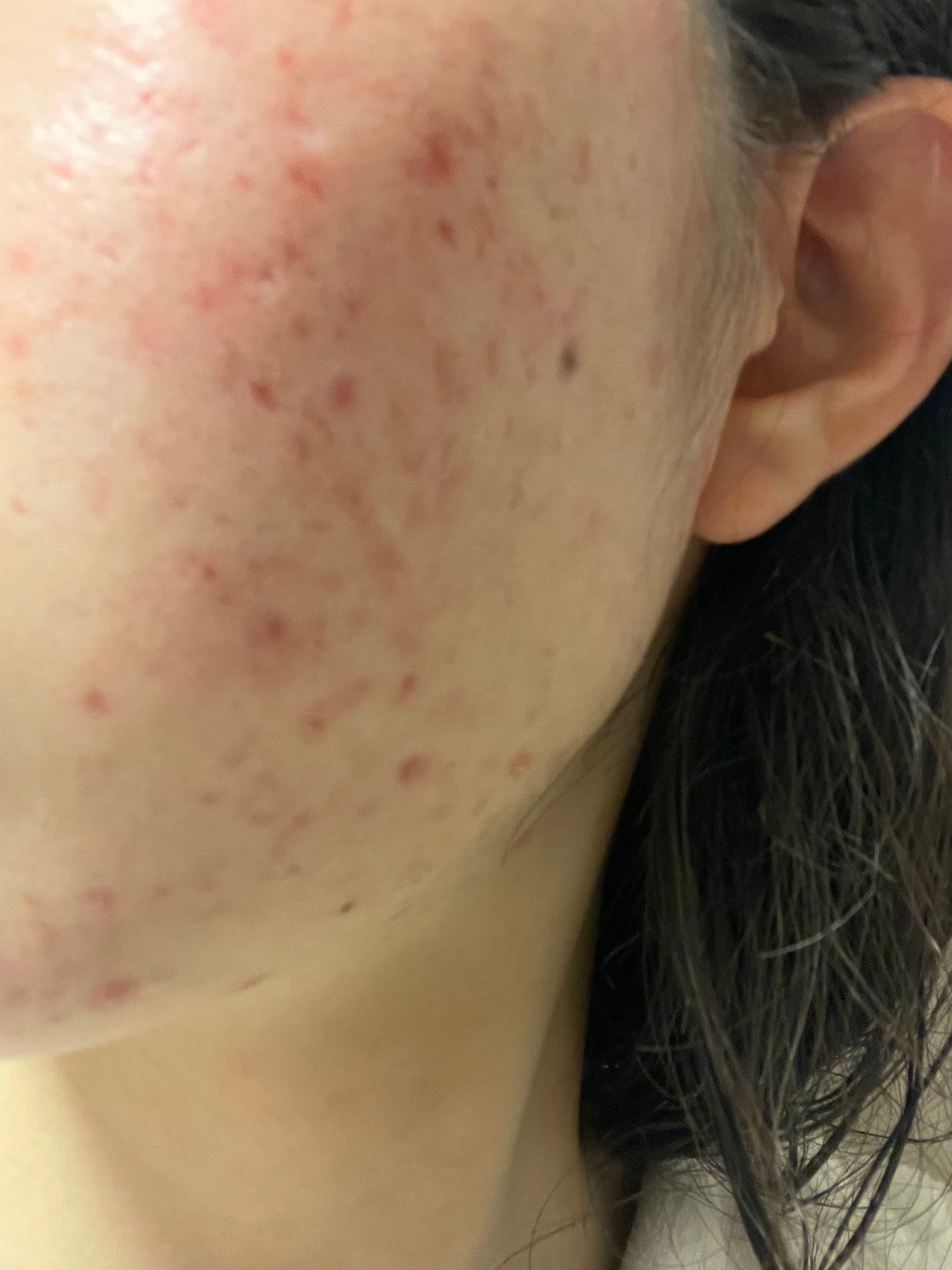 ソフティモ スーパークレンジングウォッシュ(ヒアルロン酸)/ソフティモ/洗顔フォームを使ったクチコミ(3枚目)