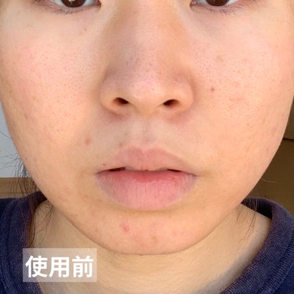 乳液・敏感肌用・さっぱりタイプ/無印良品/乳液を使ったクチコミ(7枚目)