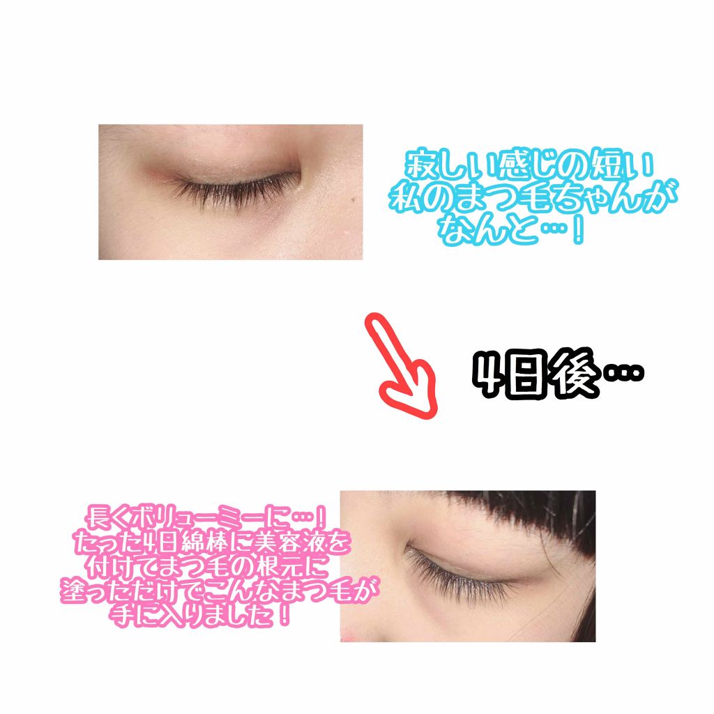 ローヤルゼリー配合 栄養ローション/DAISO/美容液を使ったクチコミ(1枚目)