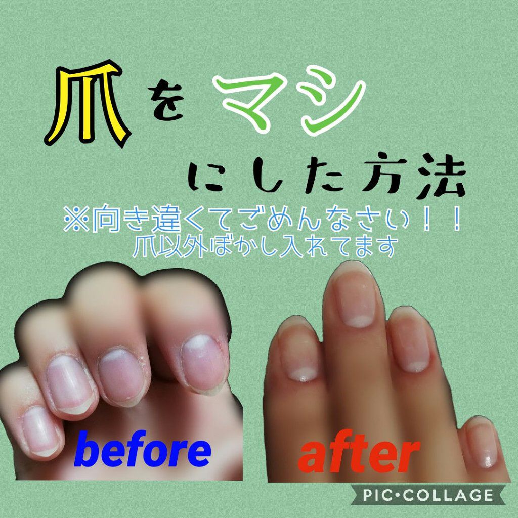 ニベアクリーム ニベアを使った口コミ こんにちは つい最近まで爪が汚かった私が By きなこもち 普通肌 10代後半 Lips
