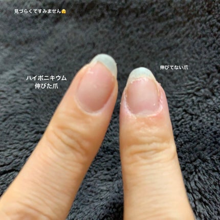 ネイルケアオイル/無印良品/ネイルオイル・トリートメントを使ったクチコミ(5枚目)