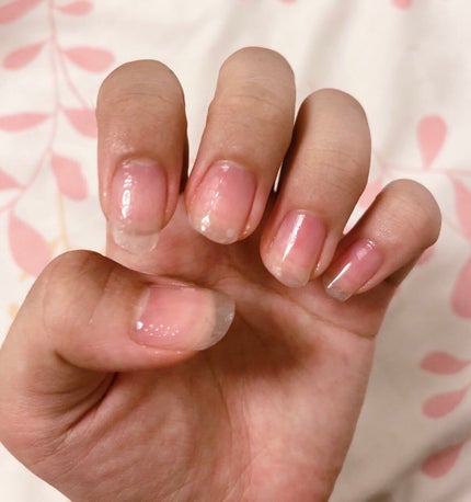 キューティクルオイル/ネイルホリック/ネイルオイル・トリートメントを使ったクチコミ(1枚目)