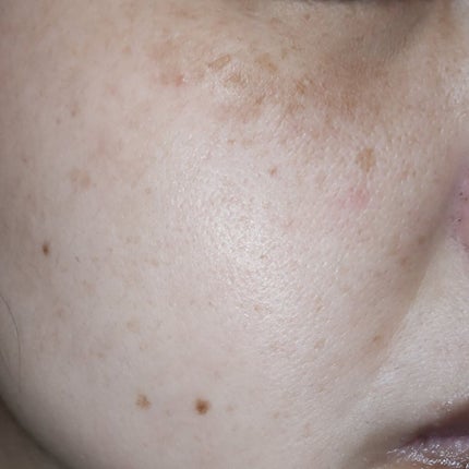 コアバランス トーニングローション/athletia/化粧水を使ったクチコミ(6枚目)