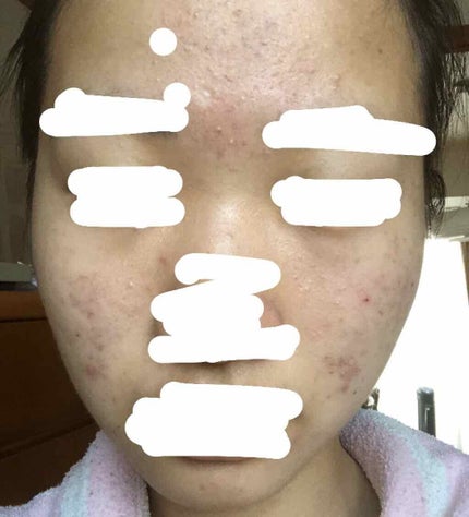 ビジャ シカバーム EX/innisfree/フェイスバームを使ったクチコミ(2枚目)