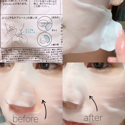 潤浸保湿 モイストリペアシートマスク/キュレル/シートマスク・パックを使ったクチコミ(4枚目)