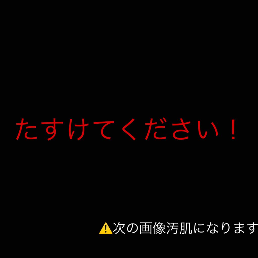 ハトムギ化粧水(ナチュリエ スキンコンディショナー R )/ナチュリエ/化粧水を使ったクチコミ（1枚目）
