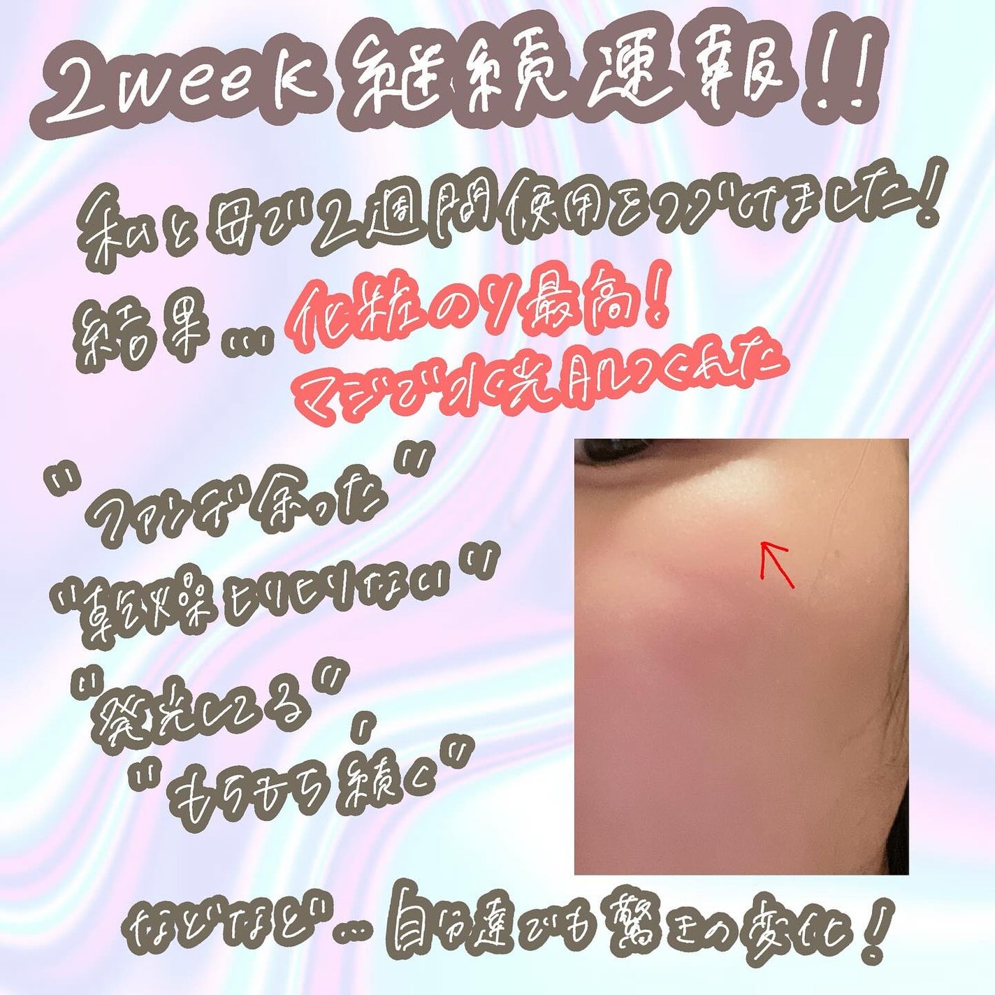 9番 NMNバイオリフト濃縮美容液/numbuzin/美容液を使ったクチコミ(2枚目)