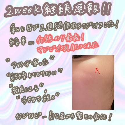 9番 NMNバイオリフト濃縮美容液/numbuzin/美容液を使ったクチコミ(2枚目)